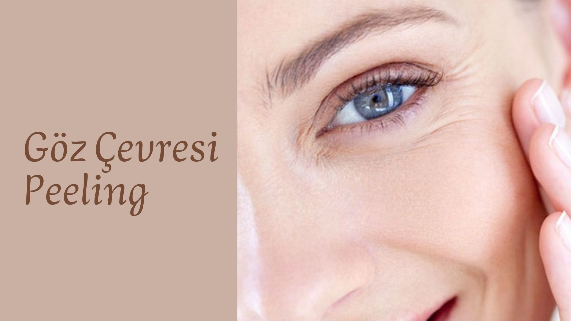 goz-cevresi-peeling